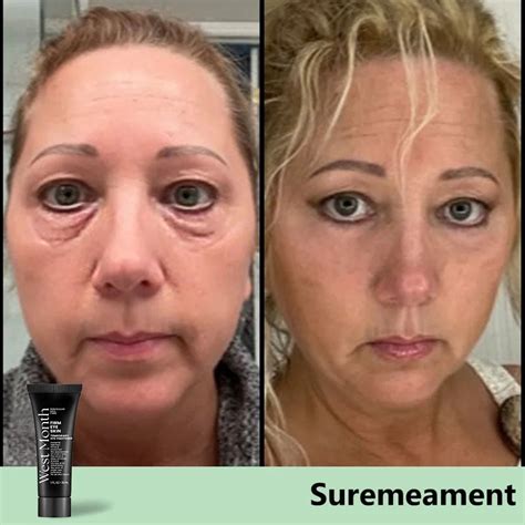 Instant FirmX Eye Bag Cream | 🔥BUY 1 GET 1 FREE🔥
