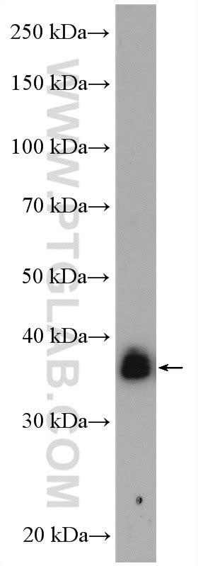 KCTD12 antibody (15523-1-AP) | Proteintech