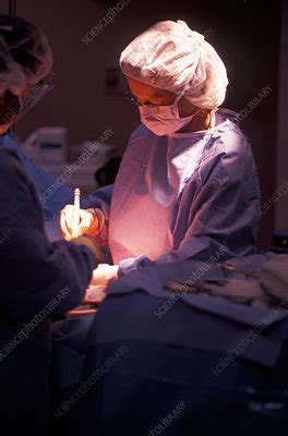 Cauterizing 的图像结果