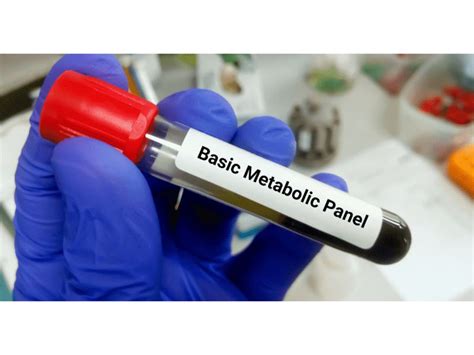 Image result for BMP Lab Values