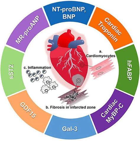 Cardiac Biomarker test