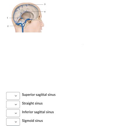 Solved Superior sagittal sinus Straight sinus Inferior | Chegg.com