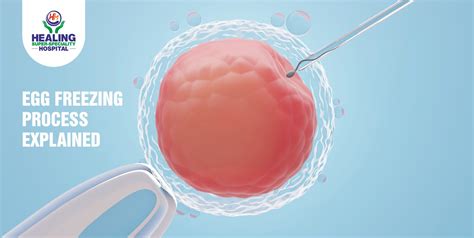 Image result for Egg Freezing Process