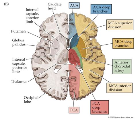Lect 23 - Aphasias and Cortical Syndromes Flashcards | Chegg.com in 2023 | Medical anatomy ...