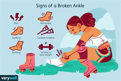 Broken Ankle Signs And Symptoms