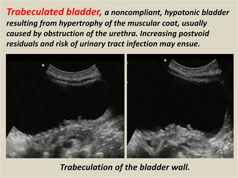 Presentation1.pptx, ultrasound examination of the urinary bladder and prostate. | PPTX