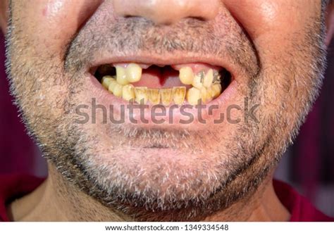Image result for Toothless Man Laughing