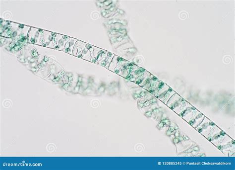 Spirogyra Under Microscope Labeled