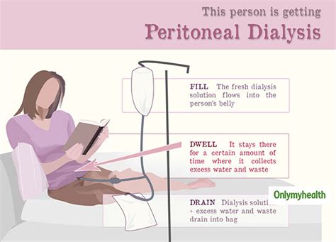 Peritoneal Dialysis (PD): Everything About Its Need, Risks And Side ...
