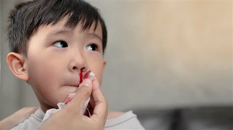 What causes nosebleeds in children?