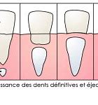 Image result for Une Dent En Or