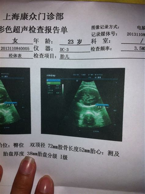 怀孕32周胎儿发育标准-菠萝孕育