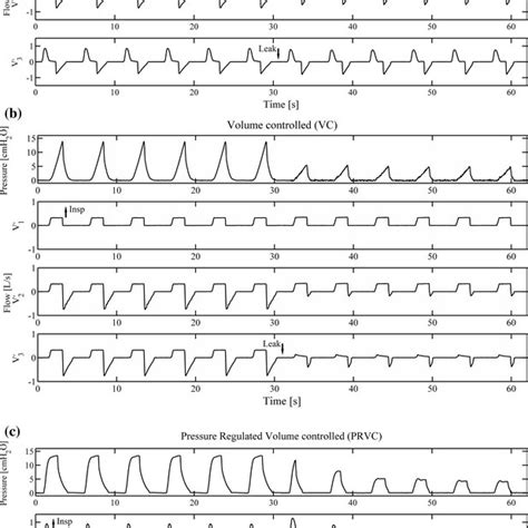 Image result for Pulse Pressure Variation Normal Range