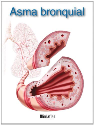 Miniatlas Asma bronquial (Spanish Edition) eBook : Lepori, Luis Raul ...