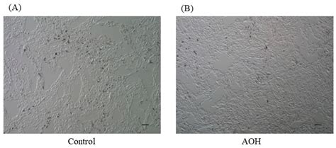 Inhibitory Effect of 2-Aza-8-oxohypoxanthine on Tyrosinase Activity and ...