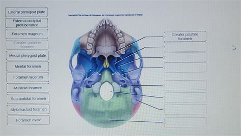 Medial And Lateral Pterygoid Plates