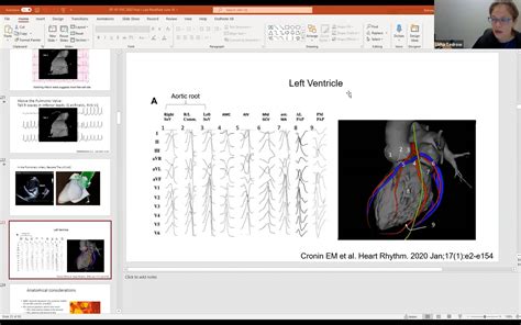 Image result for PVC Localization
