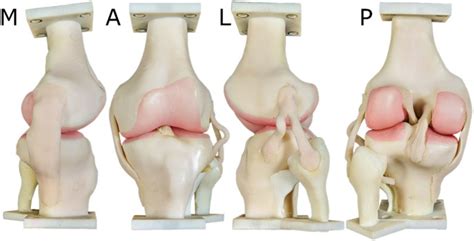 Knee Net Deep Learning Model 的图像结果