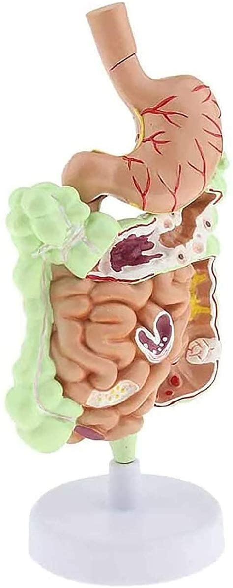 Buy Human Digestive System Model, Stomach Anatomy Large Intestine Cecum ...