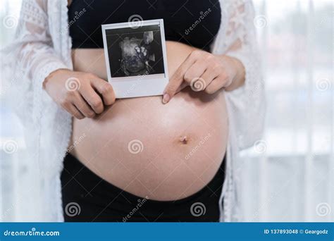 Pregnant Woman Holding Ultrasound Scan Photo Stock Photo - Image of ...
