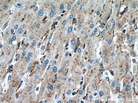 SLC25A17 antibody (67635-1-Ig) | Proteintech