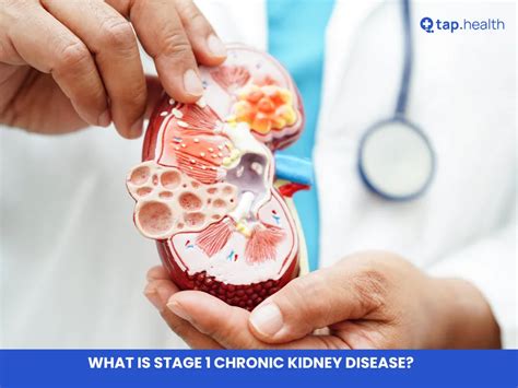 What is Stage 1 Chronic Kidney Disease?