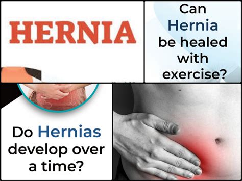 Hernia: Symptoms, Causes, Types, Risk & Treatment