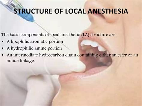 Composition of Local Anesthesia 的图像结果