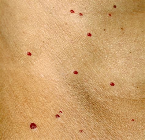 Red Dots on Skin: 19 Causes, Some Serious » Scary Symptoms