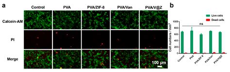 Antibacterial Vancomycin@ZIF-8 Loaded PVA Nanofiber Membrane for ...