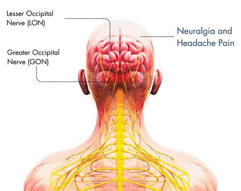 Occipital Lymph Node Behind Ear