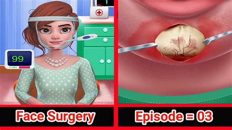 ASMR Remove 的图像结果