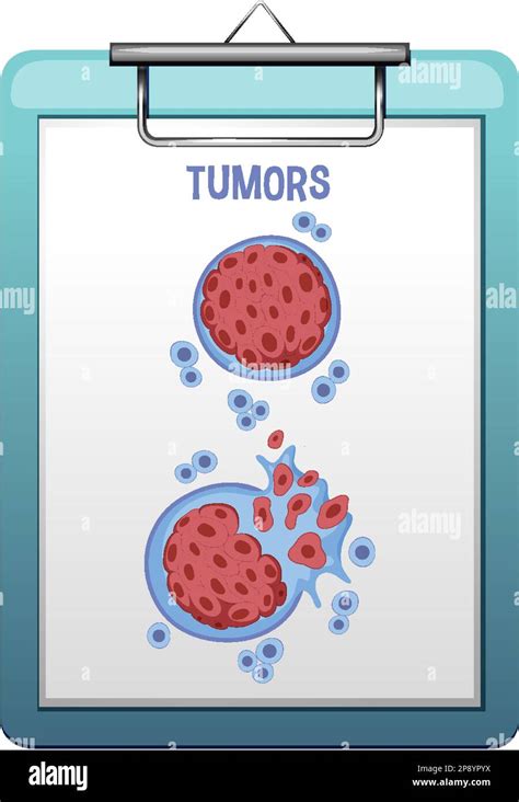 Image result for Cancer Development Cartoon