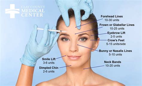 Botox Dilution 的图像结果