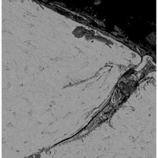 Image result for Thread Laps