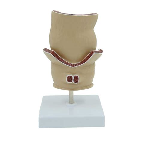 Buy ZDLZDG Human Rectal Hemorrhoid Lesions Anatomical Model Colon Anal ...