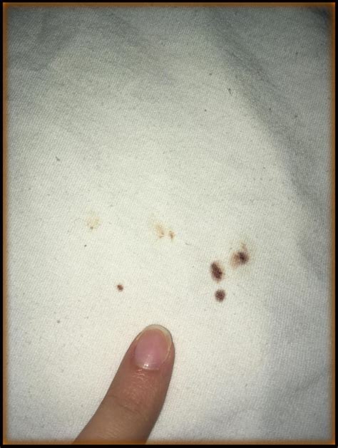 Bed Bug Images on Sheets and Pillows - Bed Bugs Pics