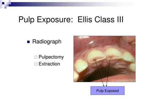 Image result for Graphical Abstract Examples of a Process