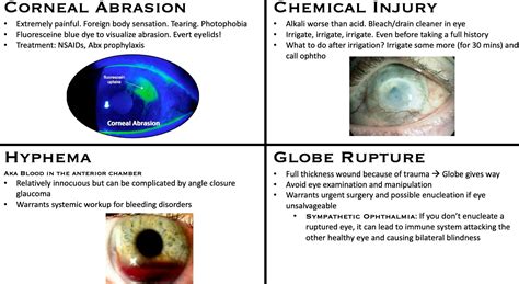 Ruptured Globe Treatment