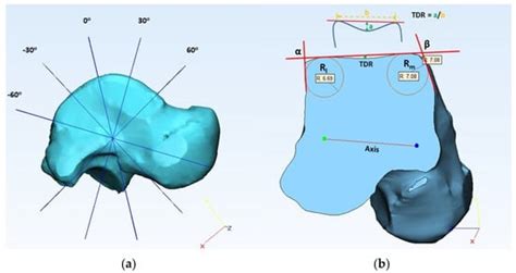 Anthropomorphic Characterization of Ankle Joint
