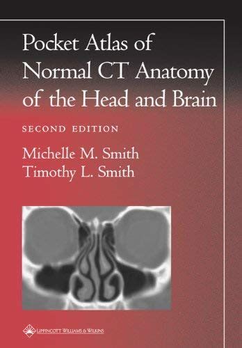 Pocket Atlas Of Normal Ct Anatomy Of The Head Brain | Desertcart INDIA