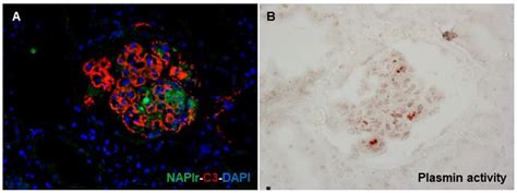 Clinico-Pathogenic Similarities and Differences between Infection ...