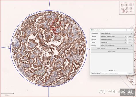 QuPath Plugins 的图像结果