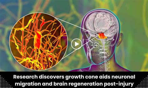 Research discovers growth cone aids neuronal migration and brain ...