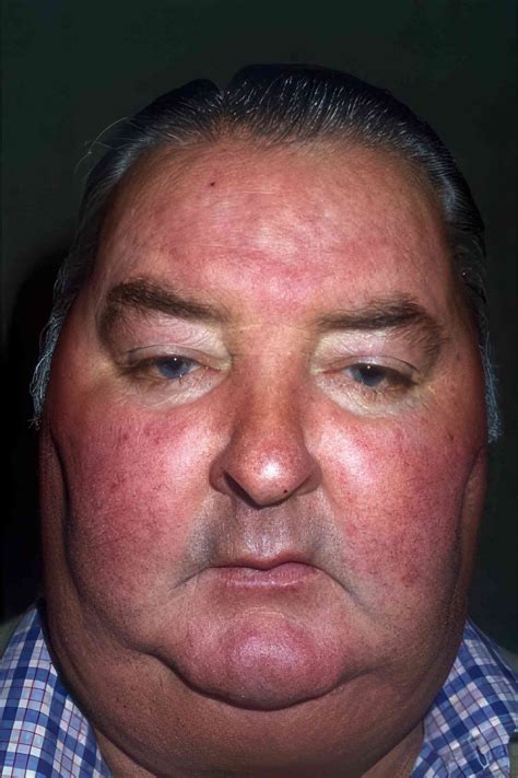 Moon 的图像结果