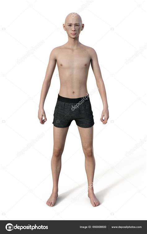 Illustration Male Body Ectomorph Body Type Characterized Lean Slender ...