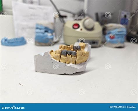 Metal Caps for the Manufacture of Dental Ceramic-metal Dental Bridges Stock Photo - Image of ...