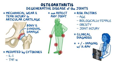 Video: Osteoarthritis: Clinical sciences | Osmosis