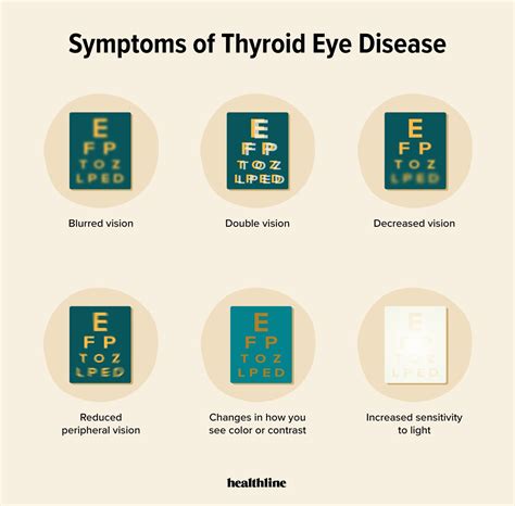 Thyroid Eye Disease and Vision Loss: Your FAQs