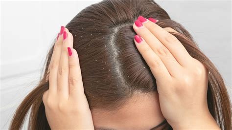 एलोवेरा में मिलाकर बालों में लगा लें ये चीज, डैंड्रफ के साथ बालों का ...